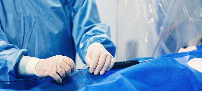 Zero fluoroscopy 